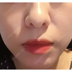 Chloe Cheongdam Clinic （クロエチョンダムクリニック）口コミ