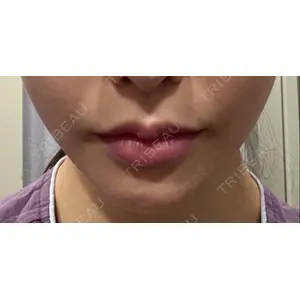 現代美学整形外科口コミ