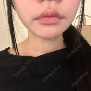 ルラ美容クリニック ルラ美容クリニック 大阪心斎橋院口コミ