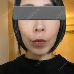 東京シンデレラ美容外科 東京シンデレラ美容外科 池袋院口コミ