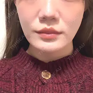 口コミ