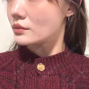 口コミ