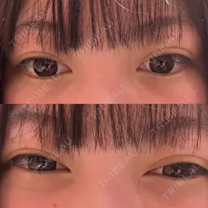 HAAB BEAUTY CLINIC 南青山本院（新院）口コミ