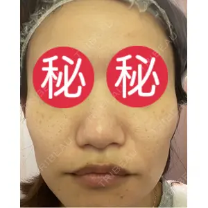 東京シルククリニック 東京シルククリニック 新宿院口コミ