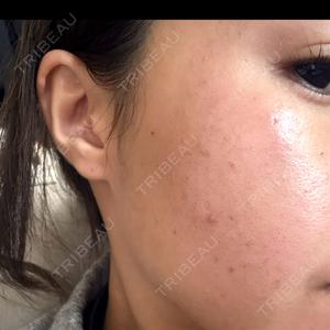 ルラ美容クリニック ルラ美容クリニック 静岡院口コミ