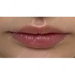 L‘amour clinic Tokyo【ラムールクリニック東京】口コミ