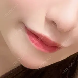 ルラ美容クリニック ルラ美容クリニック 大阪本院口コミ