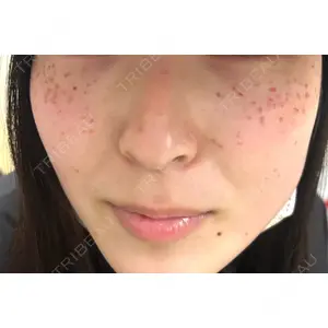 東京シルククリニック 東京シルククリニック 東京神田院口コミ