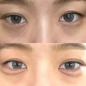 キアクリニック KIA CLINIC 心斎橋院口コミ