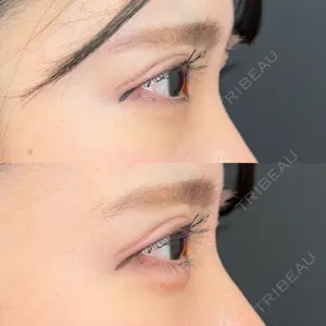 AI Beauty Clinic （エーアイ美容クリニック）口コミ