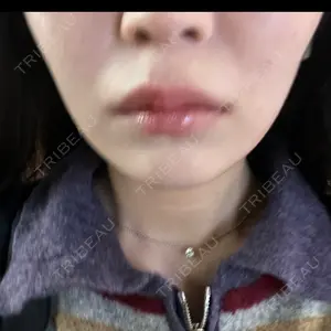 HAAB BEAUTY CLINIC 南青山本院（新院）口コミ