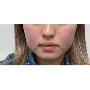 東京シルククリニック 東京シルククリニック 新宿院口コミ