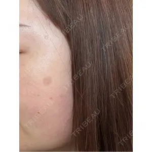 ルラ美容クリニック ルラ美容クリニック 郡山院口コミ