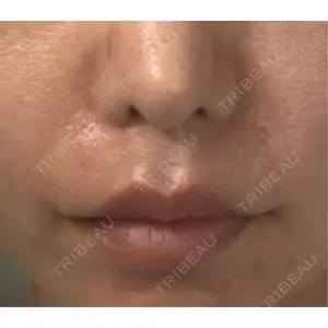 R Beauty CLINIC R Beauty CLINIC 銀座院口コミ