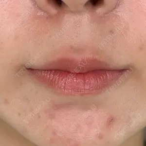 ルラ美容クリニック ルラ美容クリニック 大阪本院口コミ