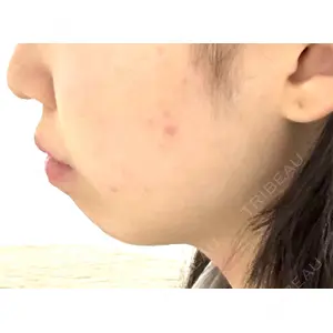 ルラ美容クリニック ルラ美容クリニック 大阪本院口コミ