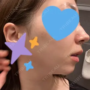 HINATA クリニック口コミ