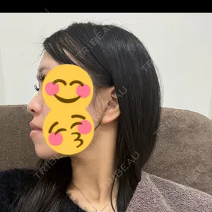 HAAB×DREAM BEAUTY CLINIC HAAB BEAUTY CLINIC 名古屋院口コミ