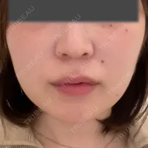 口コミ