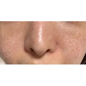 AZ BEAUTY CLINIC口コミ