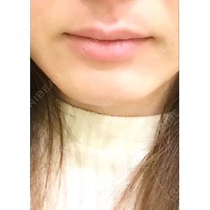 あいちビューティークリニック あいちビューティークリニック栄本院口コミ