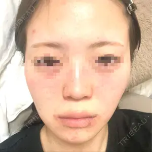 Nebula Clinic 小倉美容外科ネビュラクリニック口コミ