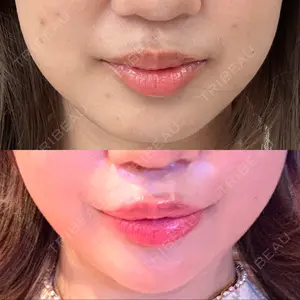 東京美容外科 東京美容外科 福岡院口コミ