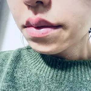 Leap beauty clinic口コミ