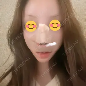 TCB東京中央美容外科 TCB東京中央美容外科 神戸院口コミ