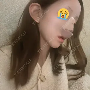 TCB東京中央美容外科 TCB東京中央美容外科 神戸院口コミ