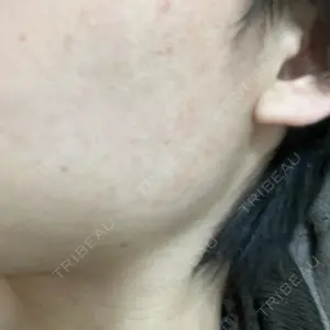 やさしい美容皮膚科・皮フ科 やさしい美容皮膚科・皮フ科　秋葉原院口コミ