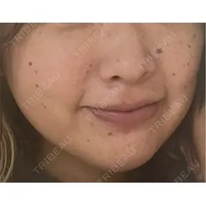 ルラ美容クリニック ルラ美容クリニック 千葉院 / ルラスキンクリニック 千葉院口コミ