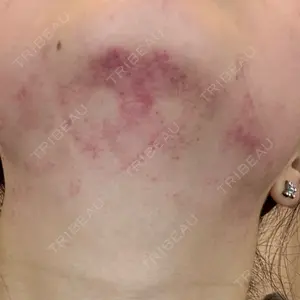 ゆきスキンクリニック 東池袋口コミ