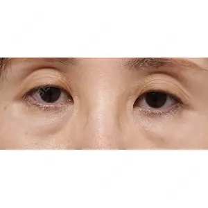 EMMA CLINIC（エマクリニック）口コミ