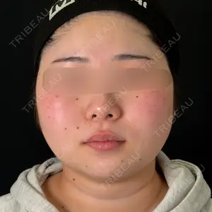 湘南美容クリニック 湘南美容クリニック 松戸院口コミ