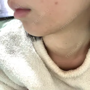 口コミ