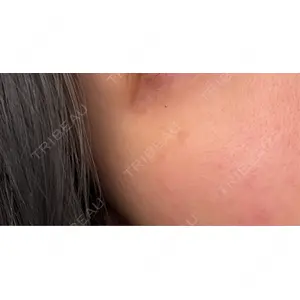 PureMe Skin Clinic（ピュアミースキンクリニック麻布）口コミ