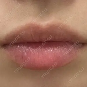 ルラ美容クリニック ルラ美容クリニック 大阪本院口コミ