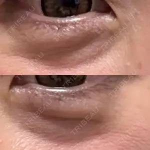 セオリークリニック口コミ