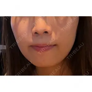 口コミ