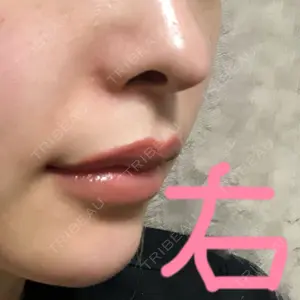 ライク整形外科口コミ