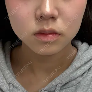 BiBiクリニック口コミ