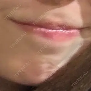 新未来クリニック口コミ