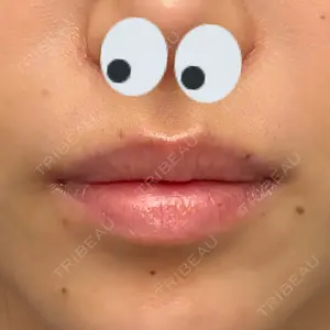 口コミ
