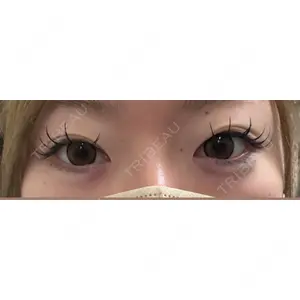 AYANAフィラーズクリニック 武蔵小杉院口コミ