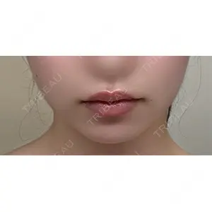 TCB東京中央美容外科 TCB東京中央美容外科 京都駅前院口コミ