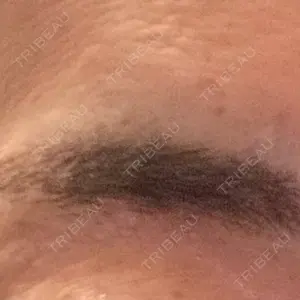 Nebula Clinic 新宿美容外科ネビュラクリニック口コミ