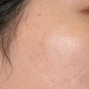 ルラ美容クリニック ルラ美容クリニック 仙台院 / ルラスキンクリニック 仙台院口コミ