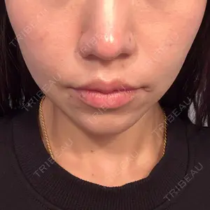 口コミ