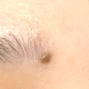 Fellez Clinic【フェルズクリニック】口コミ